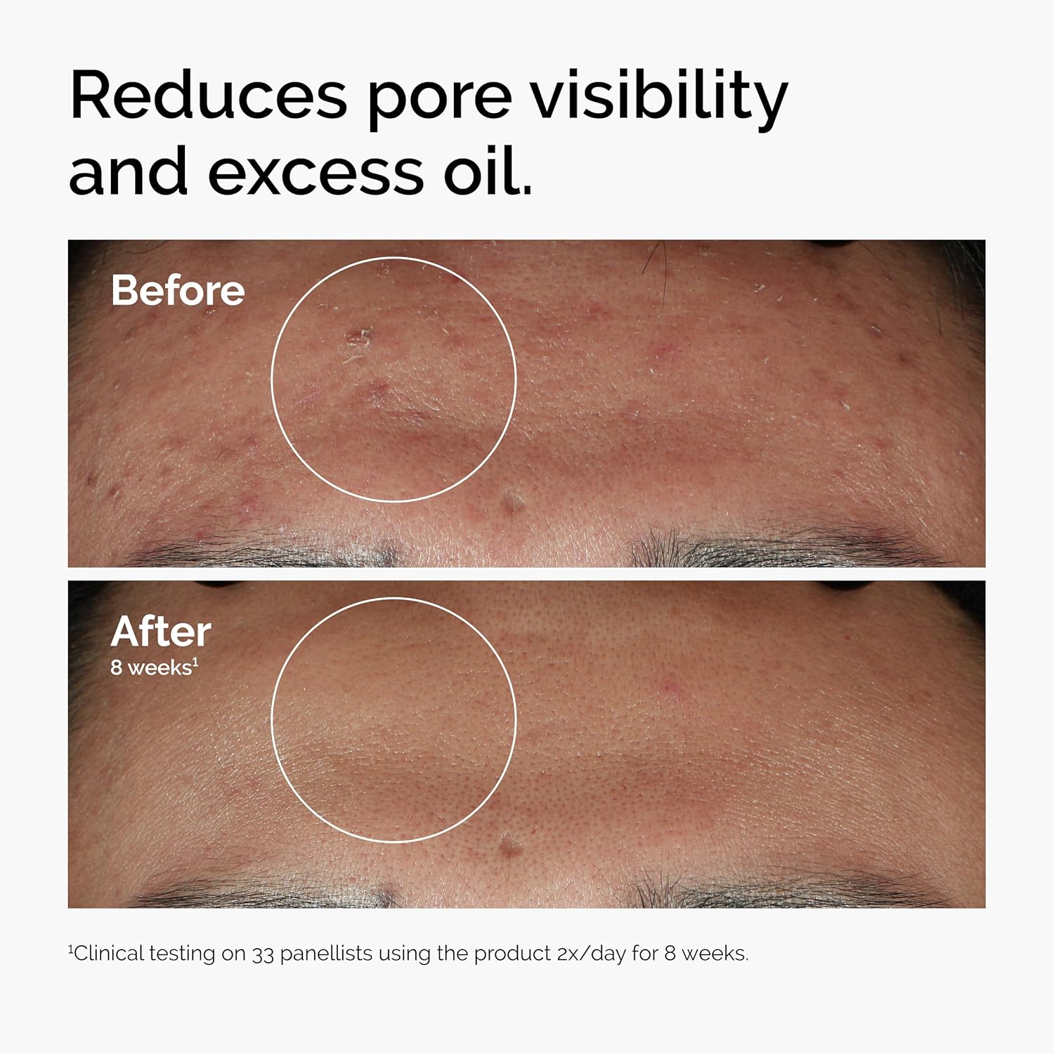 Clear Skin Boost Face Serum