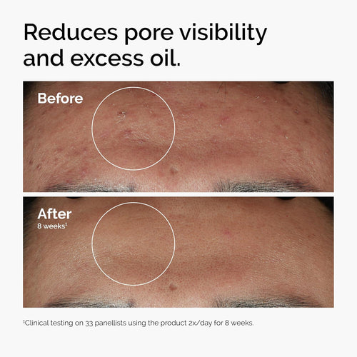 Clear Skin Boost Face Serum
