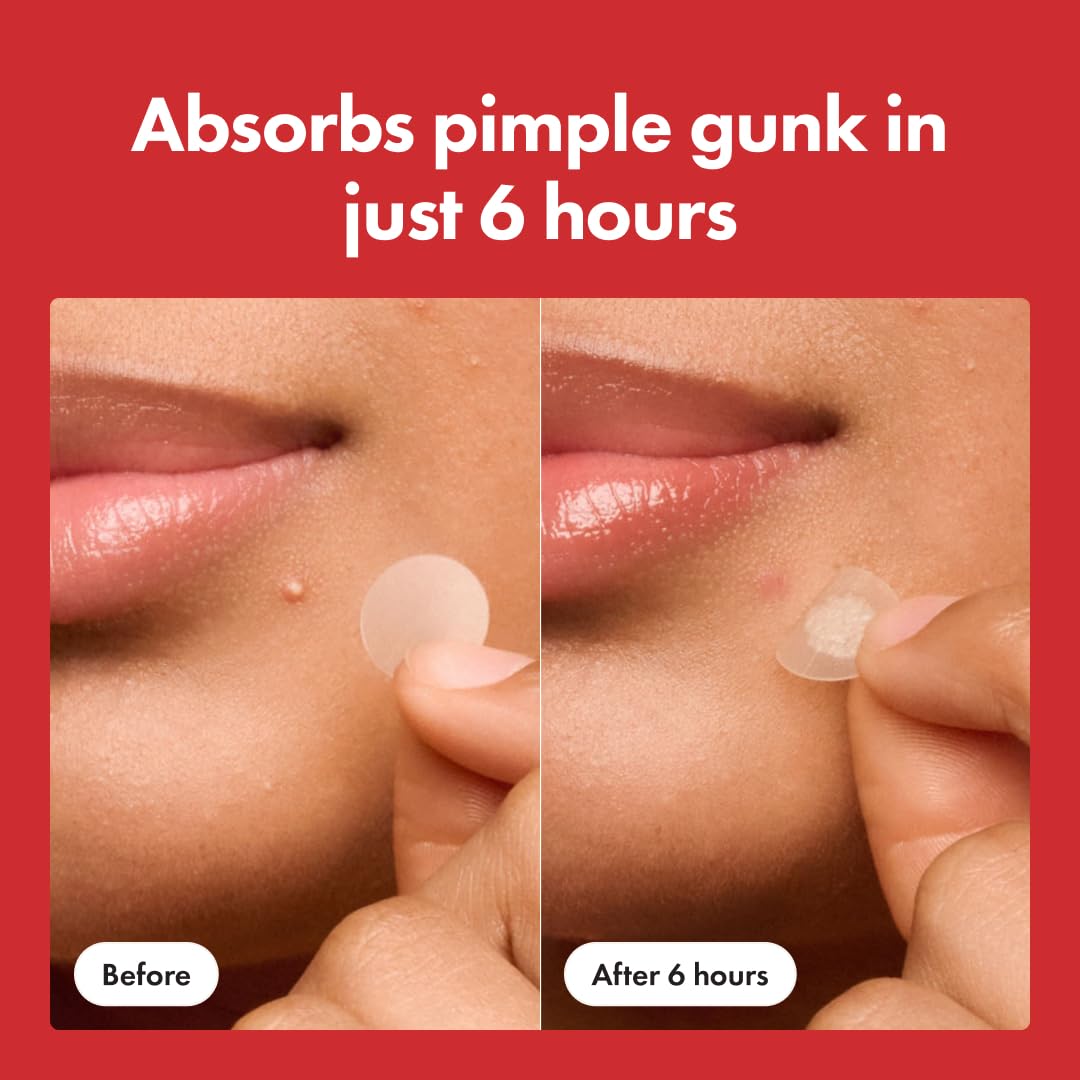 Mighty Clear Overnight Acne Patches